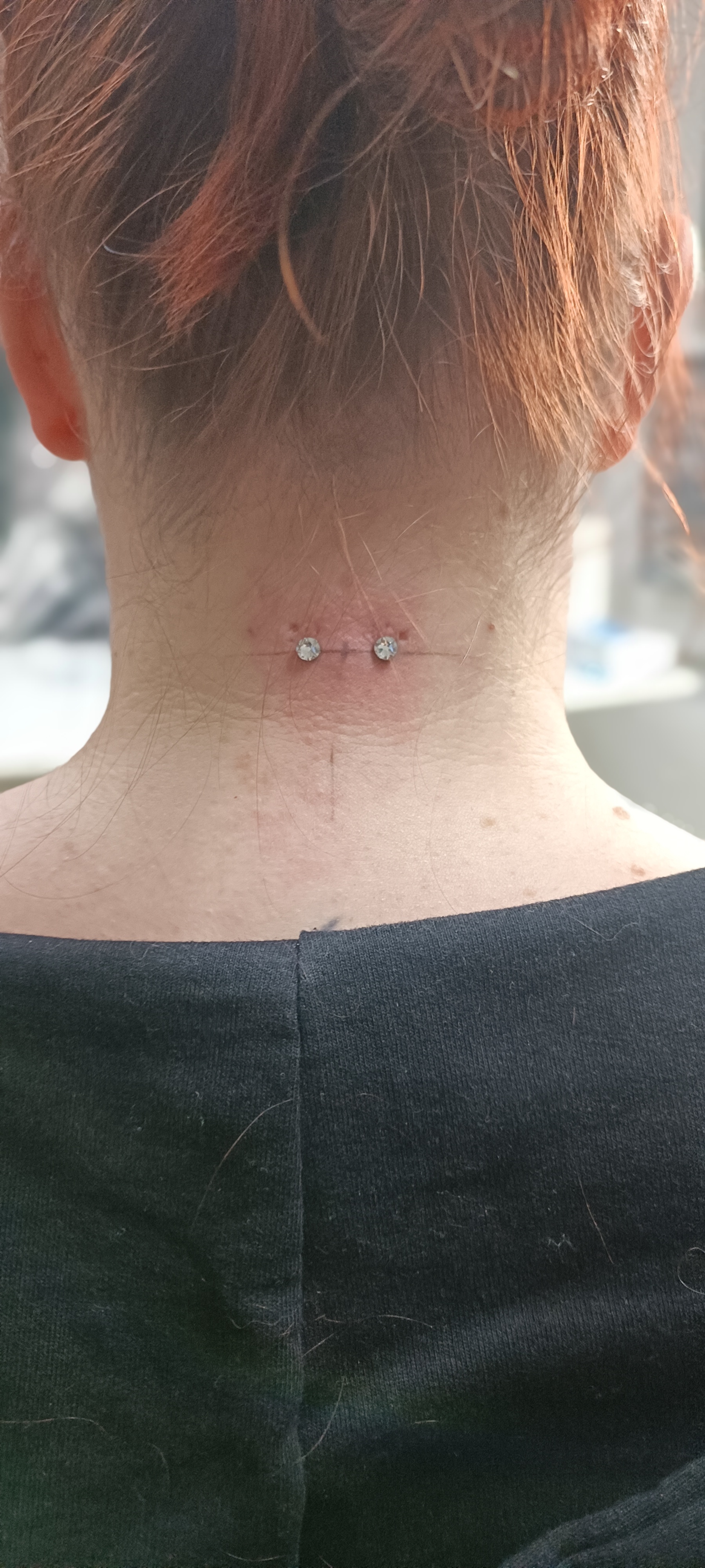 Neck Surface Bar