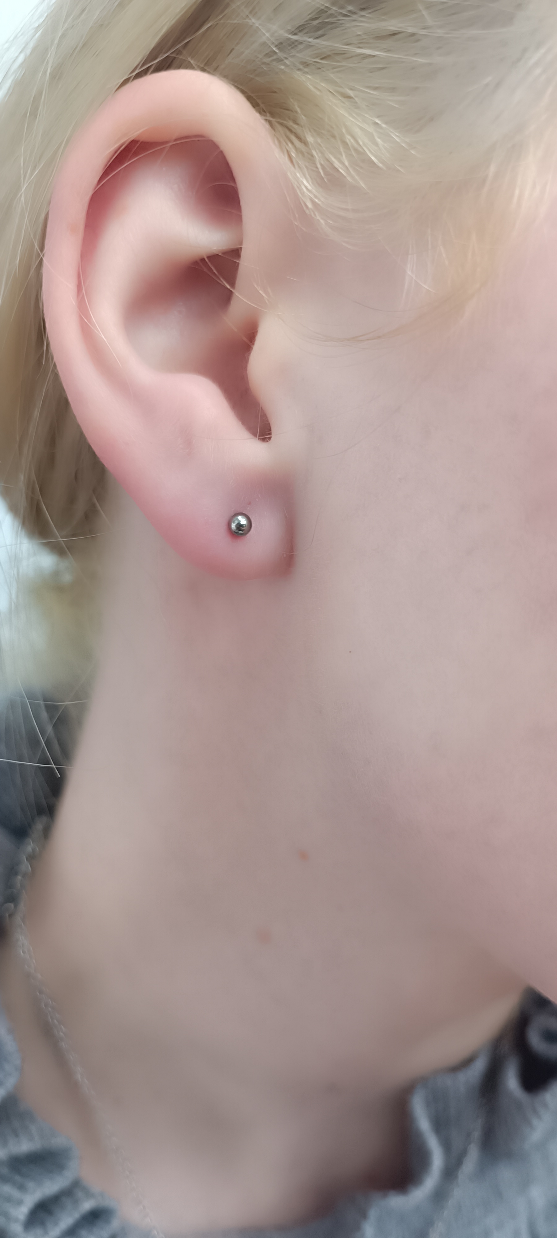 Lobe