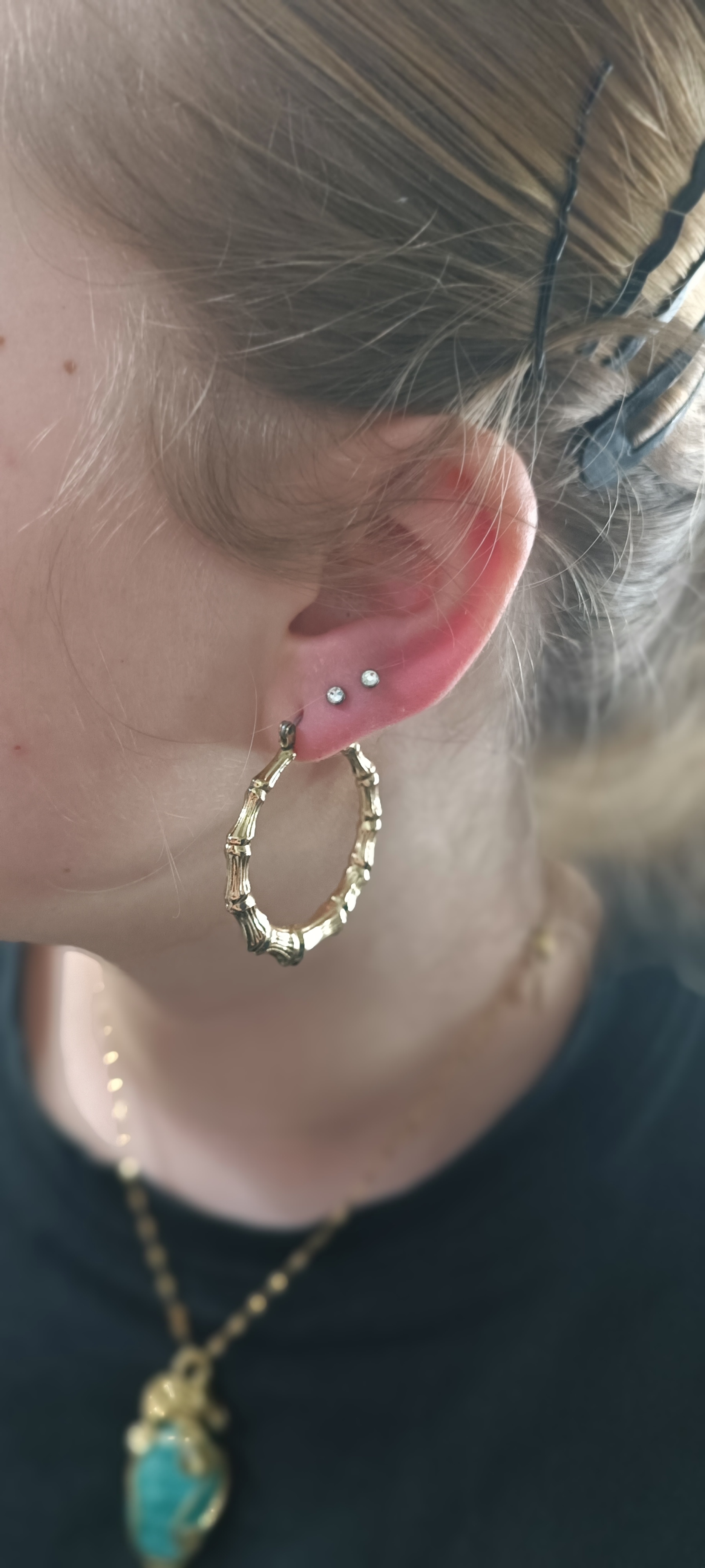 Lobe